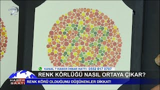 Renk Körlüğü Testi Nedir Renk Körüğü Nasıl Anlaşılır [upl. by Batchelor]