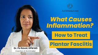 What Causes Inflammation  How to Treat Plantar Fasciitis [upl. by Demetris]