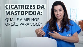 4 TIPOS DE CICATRIZES NA MASTOPEXIA Em T L Periareolar e Short Scar [upl. by Balliol]