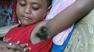 5 Saal Ki Bachi Ki Underarms WaxingJo Aap log Kabhi Nahin Dekhi Honge  Baby Underarms Hair Wax😱 [upl. by Asyram480]