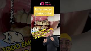 El cepillado dental es esencial dentista shorts periodontitis gingivitis humor [upl. by Yud]