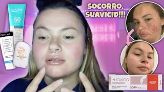 VOLTEI A USAR A POMADA SUAVICID  MELASMA  HIDROQUINONA  Ket Brinhol ✨ [upl. by Akkinahs193]