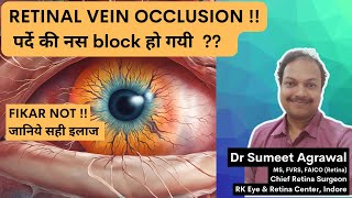 पर्दे की नस block हो जाए Retinal Vein Occlusion तो क्या करें [upl. by Sirdi382]