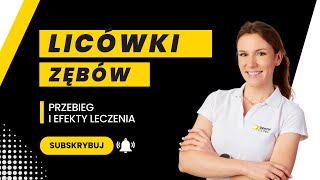 Licówki zębów Przebieg i efekty leczenia [upl. by Adamek]