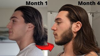 4 MONTH Minoxidil Beard Transformation  Beard Growth Results [upl. by Ardnat]