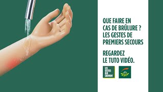 Que faire en cas de brûlure  Les gestes de premiers secours [upl. by Eyatnod]