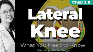 Chapter 3B⎜Lateral and Posterolateral Corner Knee⎜Visualizing MSK Radiology⎜Refer to the timeline [upl. by Appleby641]