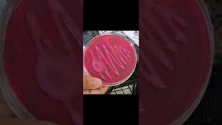 Macconkey agar microbiology macConkeyagar microbiology agar [upl. by Redvers637]