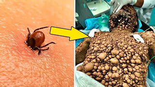 15 Insectos Con Las Picaduras Más VENENOSAS Del Mundo 😨 [upl. by Assennev]