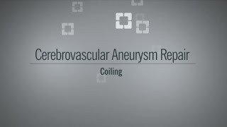 Aneurysm Coiling [upl. by Jer996]