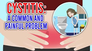 CYSTITIS Its Causes Symptoms and Treatment [upl. by Klapp]