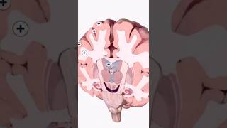 Coronal CrossSection of the Brain Detailed Anatomy Guidequot neurology [upl. by Felipe237]