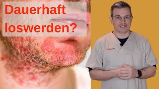 OFT nervig SELTEN schlechtes Omen Seborrhoische Dermatitis Achtung ausführliches Video [upl. by Abbotsun527]