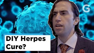 Herpes Labial Consejos y trucos [upl. by Winter]