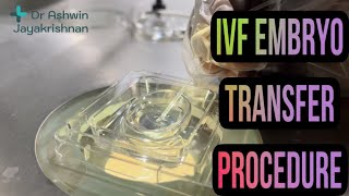 IVF  Embryo Transfer  ICSI  Dr Ashwin  malayalam video  kjk hospital  gynecology  kerala [upl. by Nisen829]