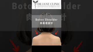 Botox TrapeziusShoulder Slimming [upl. by Forlini]