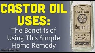 Castor Oil and Baking Soda Can Treat More Than 24 Health Problems [upl. by Rhonda]