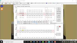 Eaglesoft Perio Charting [upl. by Eclud]