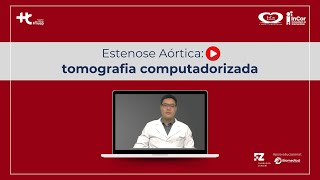 Estenose Aórtica Tomografia computadorizada [upl. by Ecirehs]