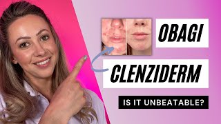 Obagi CLENZIderm MD System  UNBEATABLE ACNE RESULTS [upl. by Erreipnaej804]