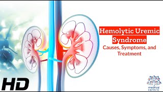 Hemolytic Uremic Syndrome A Silent Threat Unveiled [upl. by Elidad534]