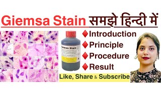 Giemsa stain in Hindi  principle  procedure  result  MLT  histopathology  Haematology [upl. by Narib]