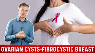 How to Remove Ovarian Cysts amp Treat Fibrocystic Breast with this ONE Mineral – DrBerg [upl. by Ailes]