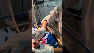 After delivery newborn baby suction 😱newbornbaby hospital shortvideo nursing shortsfeedshorts [upl. by Nivrac]