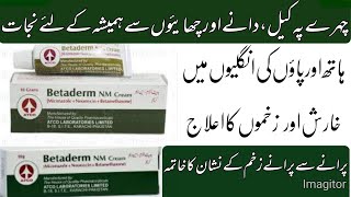 Betaderm NM cream use in Urdu [upl. by Kerby]