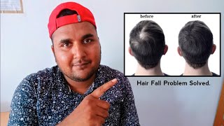 Hairfall and Hair Regrowth Treatment  Hairfall Control Best Homeopathicmedicines [upl. by Anitsrik]