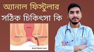 অ্যানাল ফিস্টুলার সঠিক চিকিৎসা কি  Fistula in Ano  Dr Jahidul Islam fistulatreatment [upl. by Ambert]