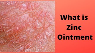 What is Zinc Ointment [upl. by Lasky]