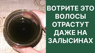 Вотрите Это Волосы Отрастут Даже на Залысинах Рецепт [upl. by Mihsah]