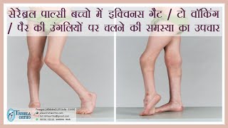 Treatment of Equinus gait toe walking walking on toes in cerebral palsy treatment at Trishla [upl. by Aneekal]