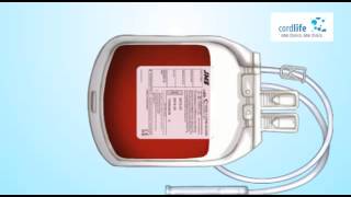 Cordlife Cord Blood Collection Process [upl. by Dnalhsa]