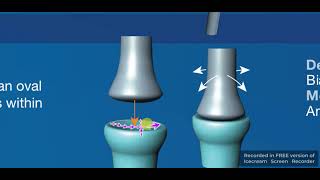 Condyloid amp Ellipsoid synovial joints [upl. by Kliman]