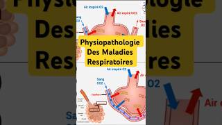 Physiopathologie Maladies Respiratoires pneumologie bronchite asthme fibrosepulmonaire poumon [upl. by Lilly957]