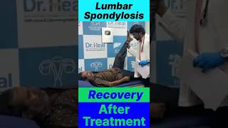 Lumbar Spondylosis Recovery After Treatment ad viralvideo motivation yt youtubeshorts fyp [upl. by Ahtebat]