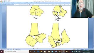 Orthopedic in Arabic17  Intercondylar fracture  by DrWahdan [upl. by Danialah947]