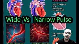 Narrow pulse pressure vs Wide Pulse pressure [upl. by Sheryl]