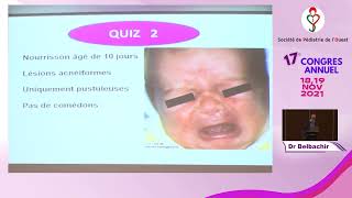 Cas cliniques en dermatologie Congrès SPO nov 2021 Dr Belbachir [upl. by Enyawud]