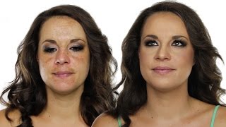 How To Cover Hyperpigmentation  Skin Pigmentation Using MakeUp  Shonagh Scott  ShowMe MakeUp [upl. by Odinevneib]