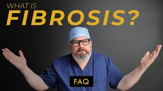 What Can You Do To Prevent FIBROSIS After Liposuction [upl. by Froemming703]