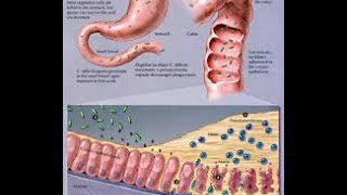 Clostridium Difficile [upl. by Etnaud]