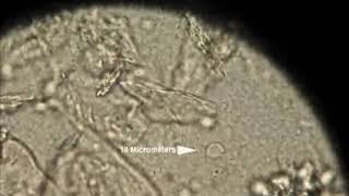 Trichomonas vaginalis on 40x microscope [upl. by Aicnerolf]