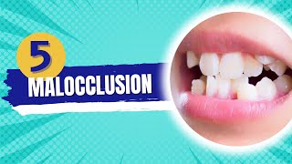 Malocclusion  Orthodontics course [upl. by Lonee433]