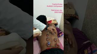 Cupping therapy available in Mettupalayam amp KaramadaiRelief physio clinic 93613 50859 [upl. by Edris889]