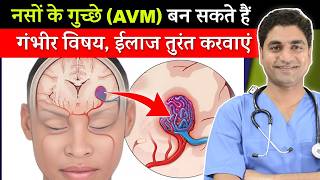 What is Arteriovenous Malformation AVM Causes Symptoms Diagnosis and Treatment [upl. by Edyaj]