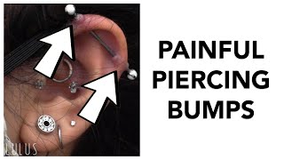 If You Do This You Will Get Piercing Bumps Testimonial [upl. by Naujat]