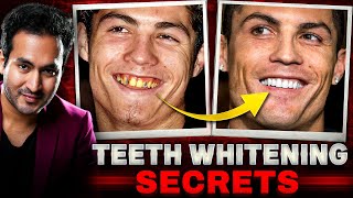 Celebrity TEETH WHITENING Secrets Revealed  Whiten 20 Shades in 1 Week [upl. by Notrab]